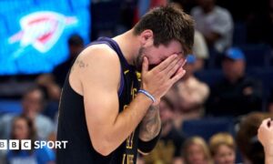 LA Lakers star Luka Doncic covers his face with his hands as he walks off the court after suffering an injury